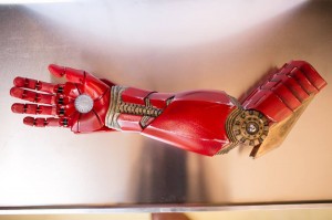 Similar type bionic arm given to Alex.